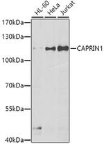 GPIP137 Antibody in Western Blot (WB)