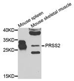 Trypsin 2 Polyclonal Antibody