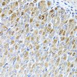 MTX2 Polyclonal Antibody