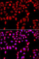 ARHGEF9 Antibody in Immunocytochemistry (ICC/IF)
