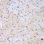 ARHGEF9 Antibody in Immunohistochemistry (Paraffin) (IHC (P))