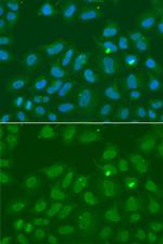 ORC6 Polyclonal Antibody