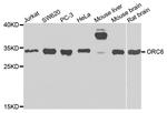 ORC6 Antibody in Western Blot (WB)