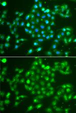 UCH37 Polyclonal Antibody