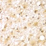 RUFY2 Polyclonal Antibody