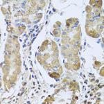 EFHC1 Polyclonal Antibody
