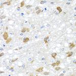 PIP4K2B Polyclonal Antibody