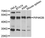 PIP4K2B Antibody in Western Blot (WB)
