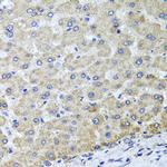 OSGEPL1 Polyclonal Antibody