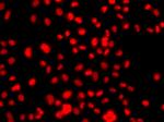 PRICKLE2 Antibody in Immunocytochemistry (ICC/IF)