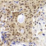 PHF19 Antibody in Immunohistochemistry (Paraffin) (IHC (P))