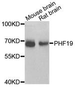 PHF19 Antibody in Western Blot (WB)