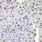 LHX4 Antibody in Immunohistochemistry (Paraffin) (IHC (P))
