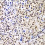 LHX4 Antibody in Immunohistochemistry (Paraffin) (IHC (P))