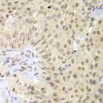 LHX4 Polyclonal Antibody