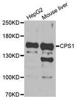 CPS1 Polyclonal Antibody