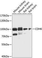 K-cadherin Antibody in Western Blot (WB)