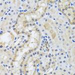Centrin 3 Polyclonal Antibody