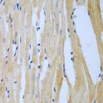 MGAT3 Polyclonal Antibody