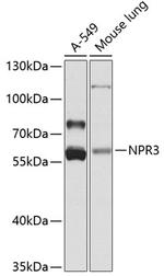 NPR3 Polyclonal Antibody