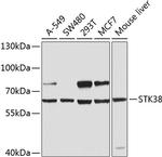 STK38 Antibody in Western Blot (WB)