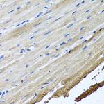 TTLL12 Antibody in Immunohistochemistry (Paraffin) (IHC (P))