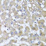TTLL12 Antibody in Immunohistochemistry (Paraffin) (IHC (P))