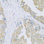 ARFGAP3 Antibody in Immunohistochemistry (Paraffin) (IHC (P))