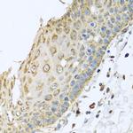 ARFGAP3 Antibody in Immunohistochemistry (Paraffin) (IHC (P))