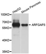 ARFGAP3 Antibody in Western Blot (WB)