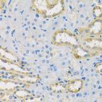 HS1BP3 Antibody in Immunohistochemistry (Paraffin) (IHC (P))