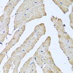 ATAD3B Polyclonal Antibody