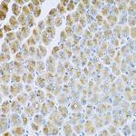 AP1M2 Polyclonal Antibody