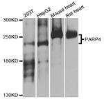 VPARP Polyclonal Antibody