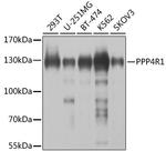 PPP4R1 Antibody in Western Blot (WB)