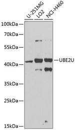 UBE2U Antibody in Western Blot (WB)