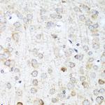 ANR52 Antibody in Immunohistochemistry (Paraffin) (IHC (P))