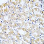 ANR52 Polyclonal Antibody