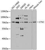Cathepsin C Antibody in Western Blot (WB)