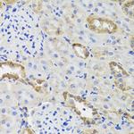 HK3 Polyclonal Antibody