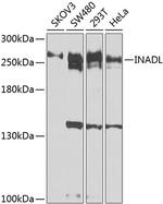PATJ Polyclonal Antibody