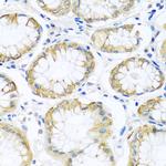 PCDHA12 Antibody in Immunohistochemistry (Paraffin) (IHC (P))