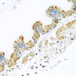 PCDHA12 Antibody in Immunohistochemistry (Paraffin) (IHC (P))