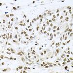 BCCIP Polyclonal Antibody