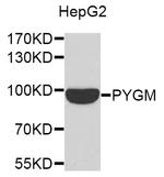 PYGM Polyclonal Antibody