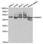 hnRNP F Antibody in Western Blot (WB)