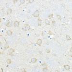 GIPR Polyclonal Antibody
