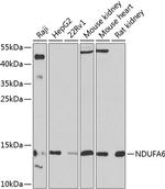 NDUFA6 Polyclonal Antibody