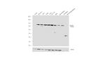 RNaseL Polyclonal Antibody