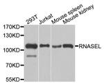 RNaseL Antibody in Western Blot (WB)